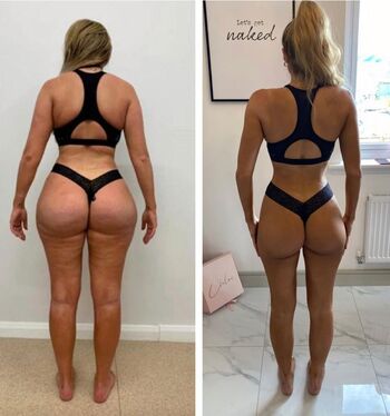 Chloe Ferry